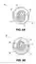 Fig. 09 - DESIGN AND APPLICATION OF A MULTI-CHAMBER CARTRIDGE INCLUDING A HYDROGEL FORMULATION