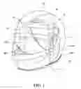 Fig. 02 - Helmet removal system and method