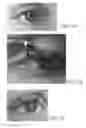 Fig. 04 - METHOD FOR POSITIONING EYELASHES DURING AN APPLICATION OF MAKE-UP AND MASCARA APPLICATION KIT