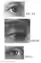 Fig. 05 - METHOD FOR POSITIONING EYELASHES DURING AN APPLICATION OF MAKE-UP AND MASCARA APPLICATION KIT