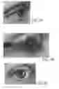 Fig. 06 - METHOD FOR POSITIONING EYELASHES DURING AN APPLICATION OF MAKE-UP AND MASCARA APPLICATION KIT