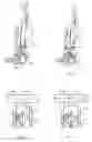 Fig. 05 - Upright vacuum cleaner