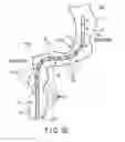 Fig. 06 - Flexible tube insertion apparatus