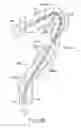 Fig. 09 - Flexible tube insertion apparatus
