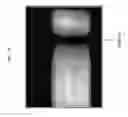 Fig. 17 - Optical sensors, systems and methods of using same