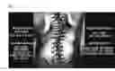 Fig. 17 - CHEST MEASURING DEVICE, SCOLIOSIS CORRECTION SYSTEM, SYSTEM FOR REMOTELY DIAGNOSING SPINE, AND WEARABLE MEASURING DEVICE