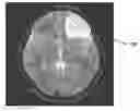 Fig. 01 - Biopsy device for coherent Raman imaging