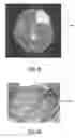 Fig. 02 - Biopsy device for coherent Raman imaging