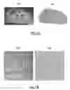 Fig. 08 - Biopsy device for coherent Raman imaging
