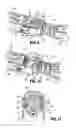 Fig. 07 - Adapter with centering mechanism for articulation joint