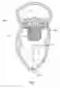 Fig. 02 - Adjustable tether and epicardial pad system for prosthetic heart valve