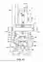 Fig. 44 - Ankle replacement system and method
