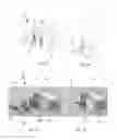 Fig. 02 - GUIDANCE DEVICE FOR ULTRASONOGRAPHY GUIDED DEVICE PLACEMENT
