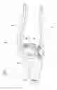 Fig. 02 - Medical instrument
