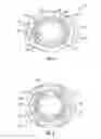 Fig. 06 - Orthopedic fixation devices and methods of installation thereof