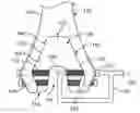 Fig. 01 - Augments and methods of implanting augments