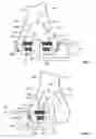 Fig. 02 - Augments and methods of implanting augments