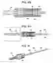 Fig. 09 - Instruments and related methods for breaking reduction tabs