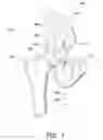 Fig. 02 - Systems and methods for determining leg length change during hip surgery