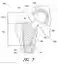 Fig. 09 - Systems and methods for determining leg length change during hip surgery
