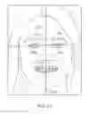 Fig. 25 - Automated 2D/3D integration and lip spline autoplacement