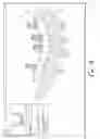 Fig. 07 - Digital design and manufacturing process for denture abutment luting bar