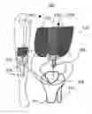 Fig. 01 - Implanted passive engineered mechanisms and methods for their use and manufacture