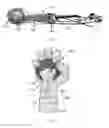 Fig. 07 - Implanted passive engineered mechanisms and methods for their use and manufacture