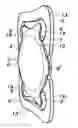 Fig. 01 - Intraocular lens structure