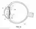 Fig. 06 - Intraocular lens structure