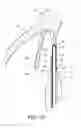 Fig. 07 - Intraocular lens structure