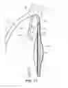 Fig. 08 - Intraocular lens structure