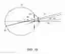 Fig. 09 - Intraocular lens structure