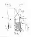 Fig. 02 - Stent seals and method of production