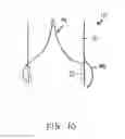 Fig. 08 - Stent seals and method of production