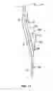 Fig. 09 - Stent seals and method of production