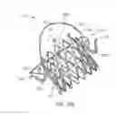 Fig. 09 - Mitral valve prosthesis implantation