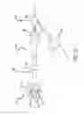 Fig. 08 - Inversion delivery device and method for a prosthesis
