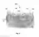Fig. 07 - Aortic annular support system