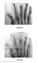 Fig. 08 - SYSTEM AND METHOD FOR FABRICATING A BODY PART MODEL USING MULTI-MATERIAL ADDITIVE MANUFACTURING