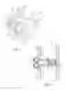 Fig. 02 - Expandable interspinous process fixation device