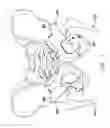 Fig. 02 - TELESCOPIC GUIDE FOR HIP REPLACEMENT METHOD