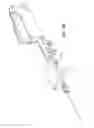Fig. 06 - Transluminal delivery devices and related kits and methods