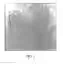 Fig. 02 - Control system for controlling the inflation of a balloon in a balloon stent catheter system