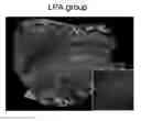 Fig. 01 - Leukocyte infiltration promoting agent and antitumor immunostimulatory agent