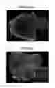 Fig. 02 - Leukocyte infiltration promoting agent and antitumor immunostimulatory agent