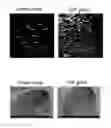Fig. 03 - Leukocyte infiltration promoting agent and antitumor immunostimulatory agent