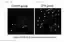 Fig. 04 - Leukocyte infiltration promoting agent and antitumor immunostimulatory agent