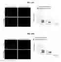 Fig. 45 - Method for treating a degenerative neurological disorders comprising administering ASM inhibitor