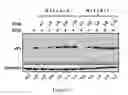 Fig. 07 - Combination therapy for EV71 infection